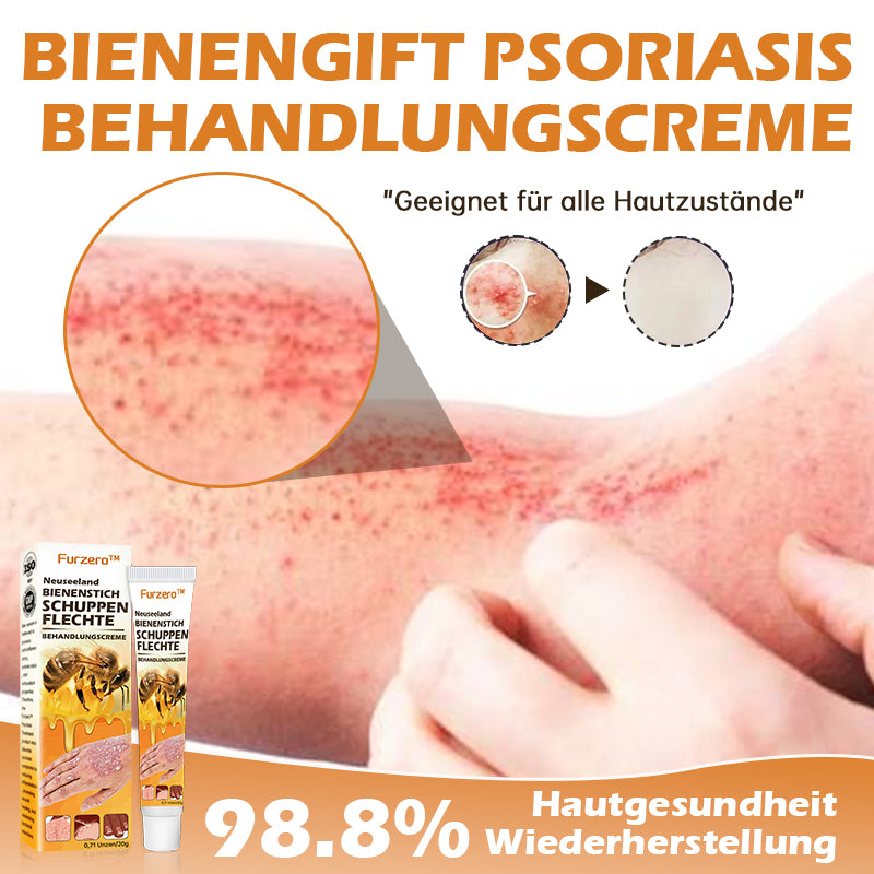 🐝Furzero™ Neuseeland Bienengift Psoriasis-Behandlungscreme (Geeignet für alle Hautbedingungen)