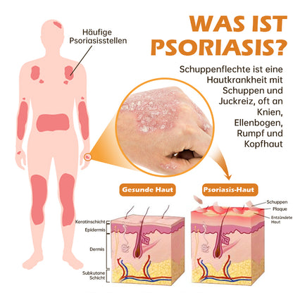 🐝Furzero™ Neuseeland Bienengift Psoriasis-Behandlungscreme (Geeignet für alle Hautbedingungen)