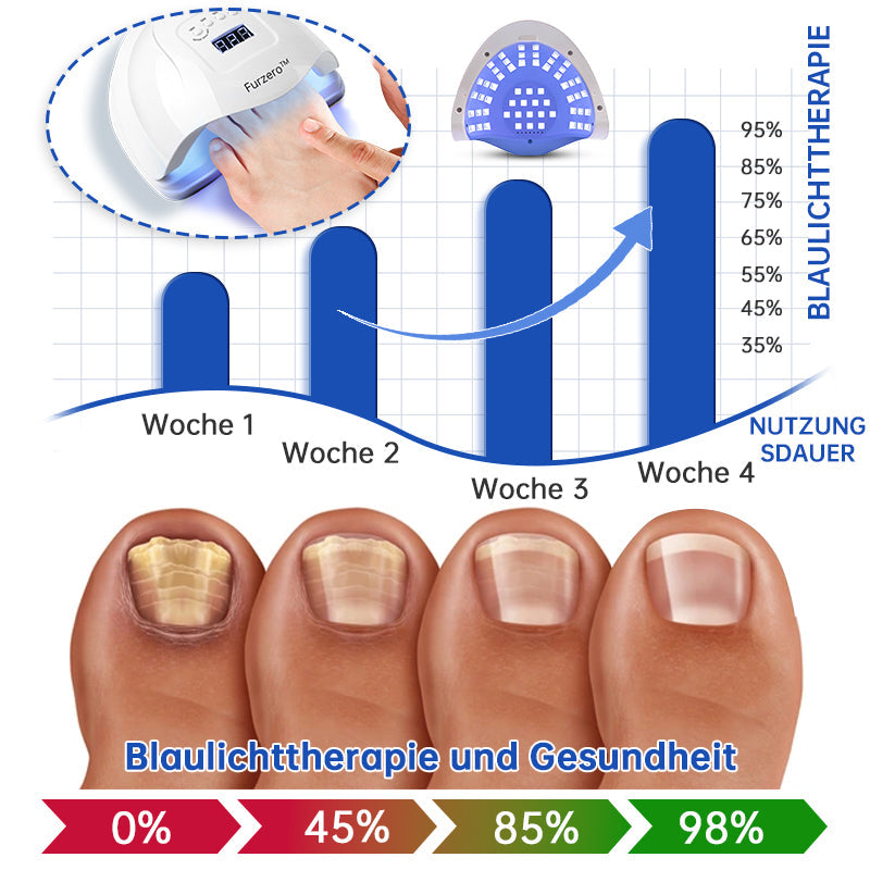 👍Furzero™ PureNail Pilz-Lasertherapiegerät