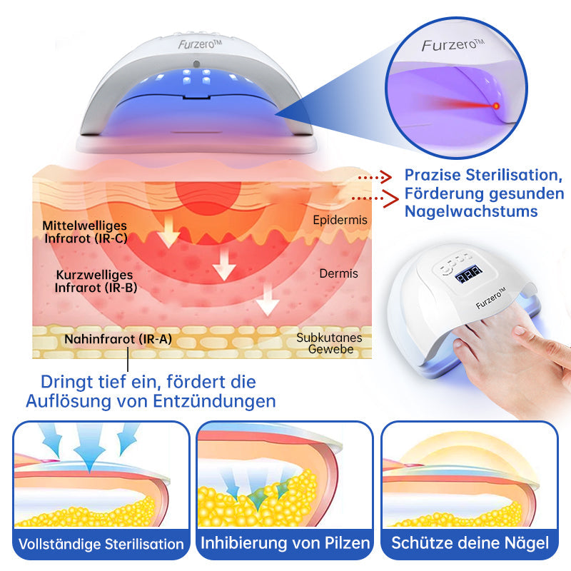 👍Furzero™ PureNail Pilz-Lasertherapiegerät