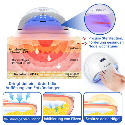 👍Furzero™ PureNail Pilz-Lasertherapiegerät