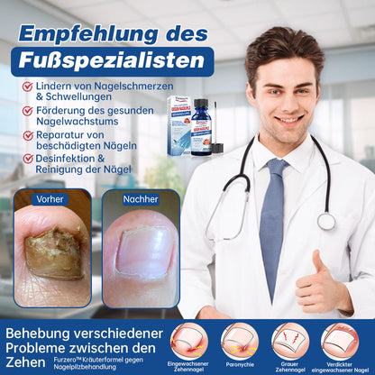 Furzero™ Herbal Formula Nagelpilz-Paronychie-Behandlungsgel Pro