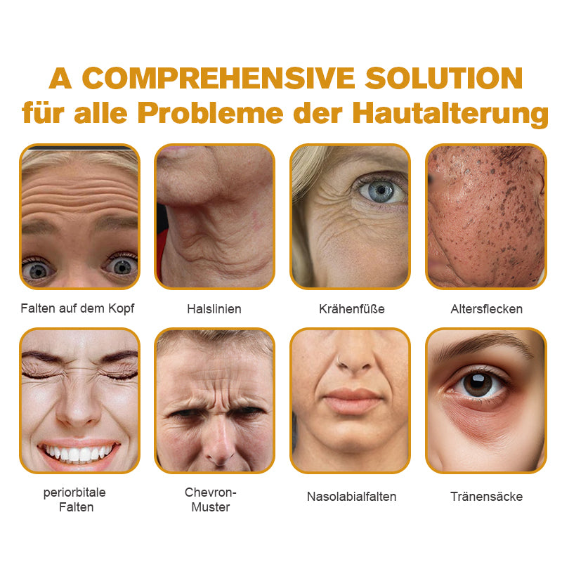 (🌿Hergestellt und versandt aus Deutschland✅)✨Furzero™ Botox Bienengift Falten- und Fleckencreme Pro