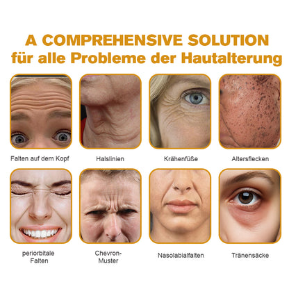 (🌿Hergestellt und versandt aus Deutschland✅)✨Furzero™ Botox Bienengift Falten- und Fleckencreme Pro